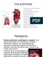 Edema-Pulmonar