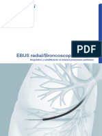 Radial EBUS Ultrathin Bronchoscopy Procedure Guide - Us ES PDF