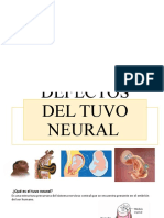 Defectos Del Tuvo Neural