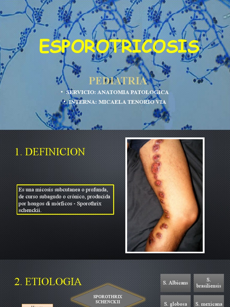esporotricosis-pdf-tuberculosis-especialidades-medicas