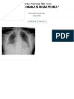 Thorax PDF