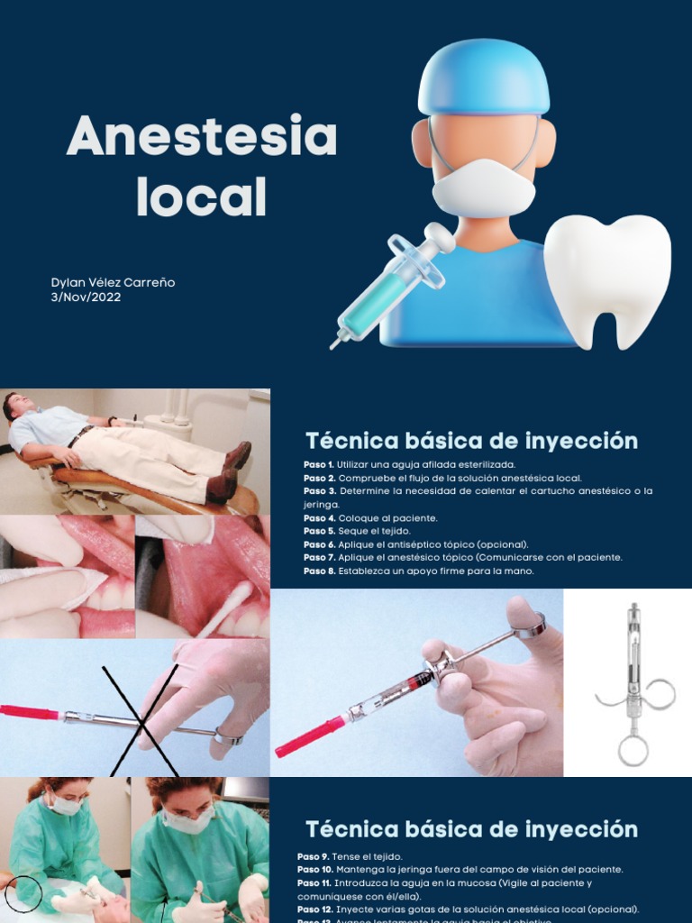 Técnicas de Anestesia Local en Odontología | PDF | Inyección (medicina ...