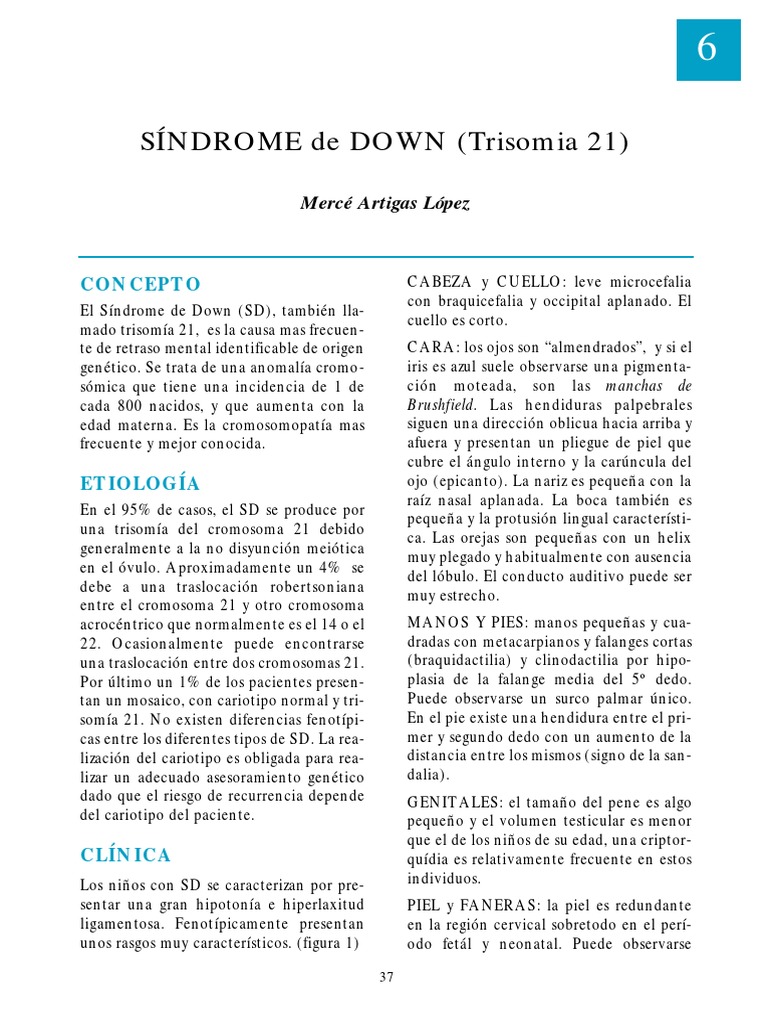 SD Trisomia 21 | PDF | Síndrome de Down | Especialidades Medicas