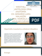 Hipertrofia Del Masetero PDF