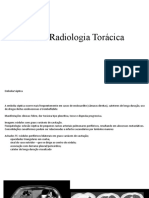 Casos Radiologia Torácica - EC SPR