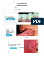 Taller de Patologia Oral 2012-1