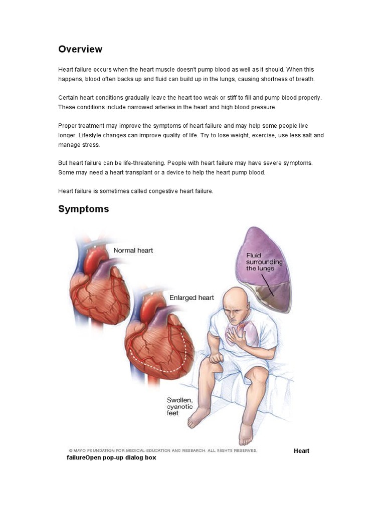 Understanding Heart Failure Symptoms & Causes | PDF | Heart | Heart Failure