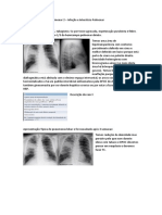 Seminário Imagiologia Pulmonar 2