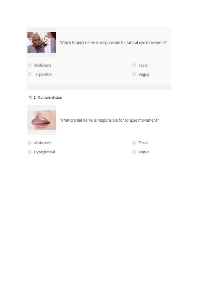 Cranial Nerve Quiz Spot The Imposter - evfdw7k