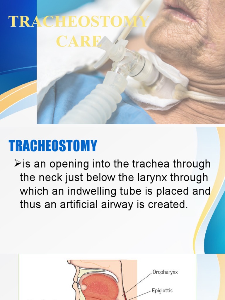 Tracheostomy Care and Management Guide | PDF | Science & Mathematics