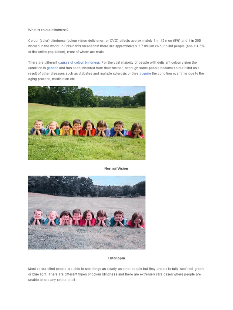 Color Blindness Pdf Color Visual System