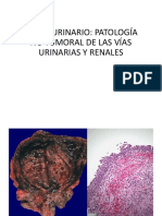 Patología no tumoral de las vías urinarias y renales