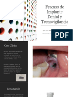Fracaso de Implante Dental y Tecnovigilancia