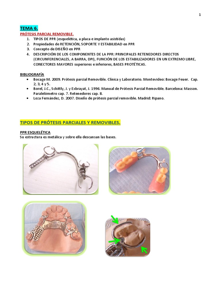 componentes-y-tipos-de-ppr-pdf-dentadura-postiza-ramas-de-odontolog-a