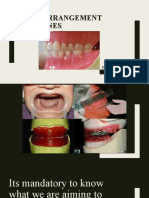 Teeth Arrangement Guidelines