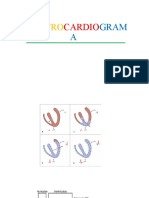 EKG Presentacion AMS