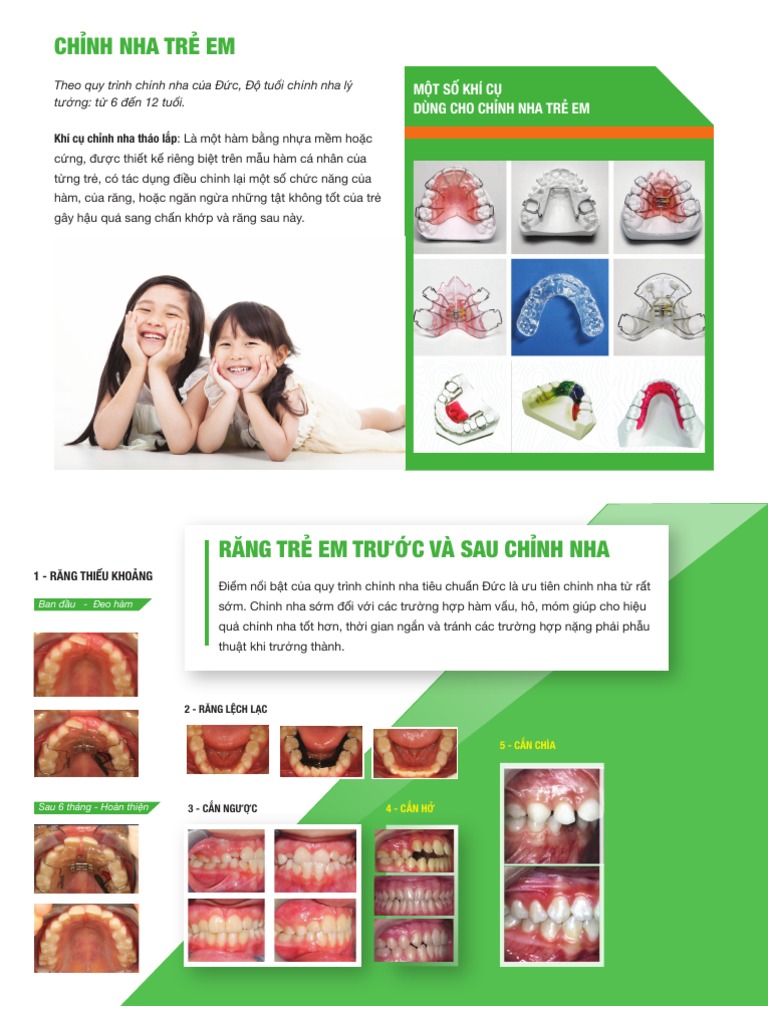 Chinh Nha Tre em Brochure 1 | PDF