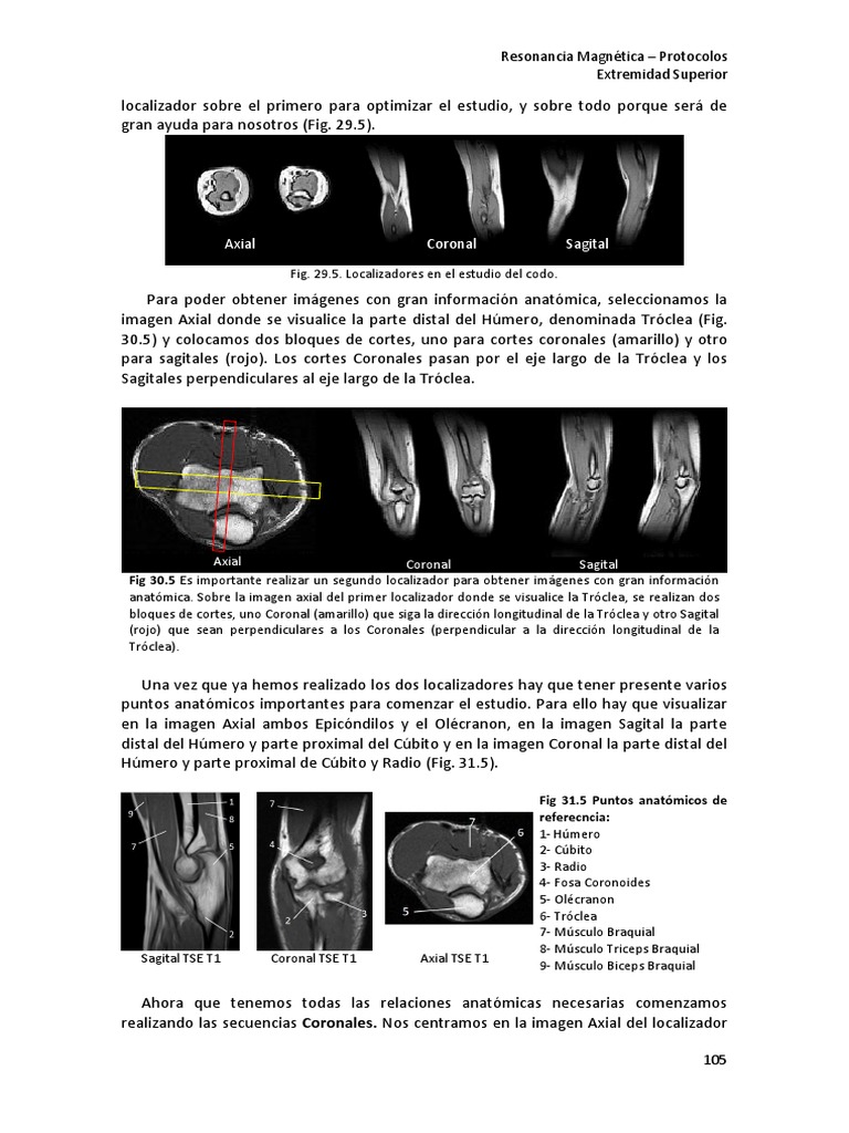 RM de Codo PDF Descargar gratis PDF Codo Sistema esquelético