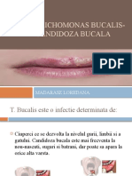 Trichomonas Bucalis - Candidoza Bucala