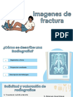 Imagenes de Fractura