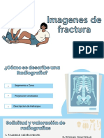 Imagenes de fracturas óseas