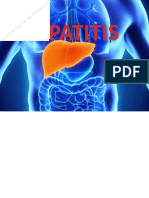 HEPATITIOS