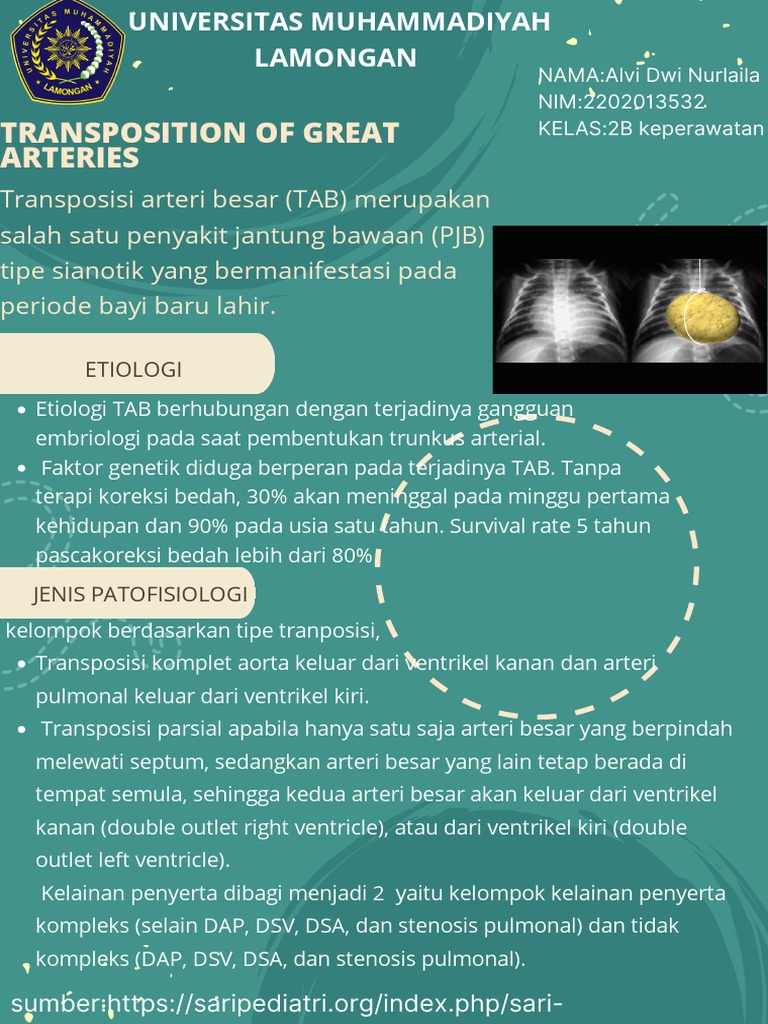 transposition-of-the-great-arteri-pdf