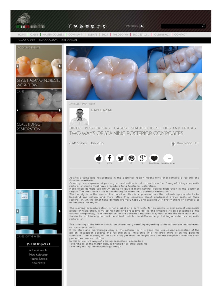 Two Ways of Staining Posterior Composites PDF Dentistry Prosthodontics
