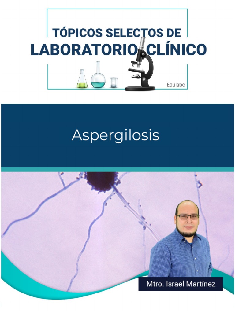 aspergilosis-pdf-sistema-inmune-alergia