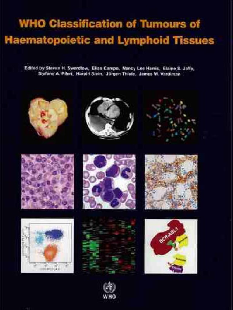 WHO Classification of Tumours of Haematopoietic and Lymphoid Tissues ...