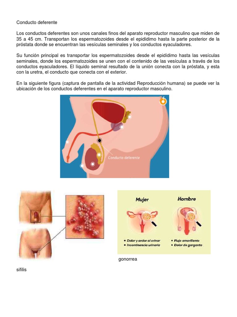 Conductos PDF