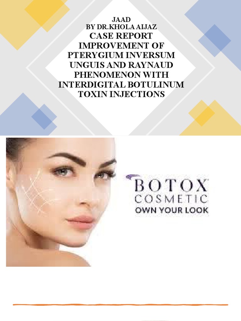 Botox for Pterygium and Raynaud's Relief | PDF | Botulinum Toxin ...