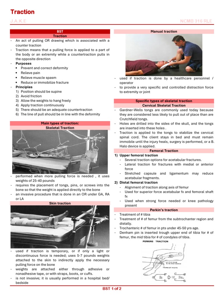 316 RLE Balance Skeletal Traction (BST) PDF Knee Hip