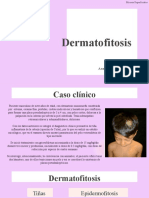 DERMATOFITOSIS1