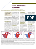 Ducto Arterioso