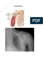 Bones Notes Mbbs