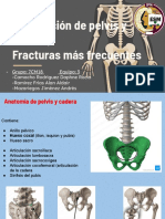 Exploración de Pelvis y Cadera, Fracturas Más Frecuentes