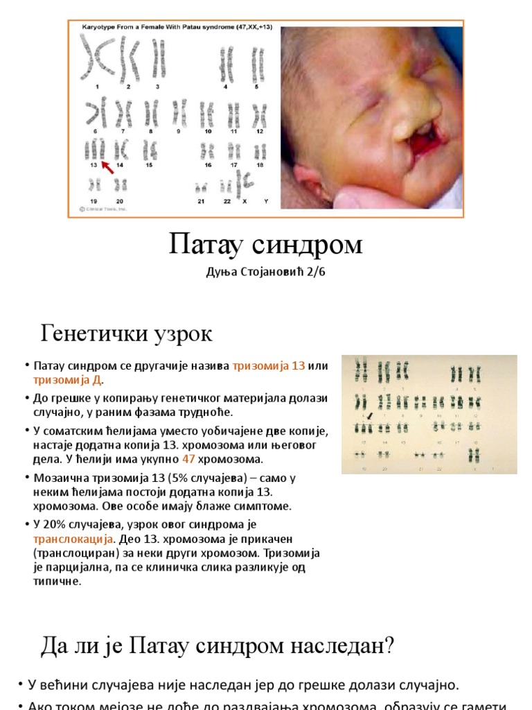 Патау синдром | PDF