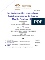 Les Fractures Orbito-Zygomatiques: Expérience Du Service de Chirurgie Maxillo-Faciale de l'HMA