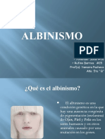 Albinismo