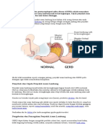 Penanganan Penyakit Asam Lambung atau GERD