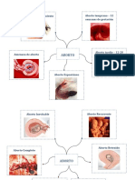 Tipos de Abortos