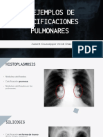 Tarea Calcificaciones-Verdi - Jubelt PDF