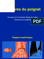 01 Poignet - Fractures.ppt