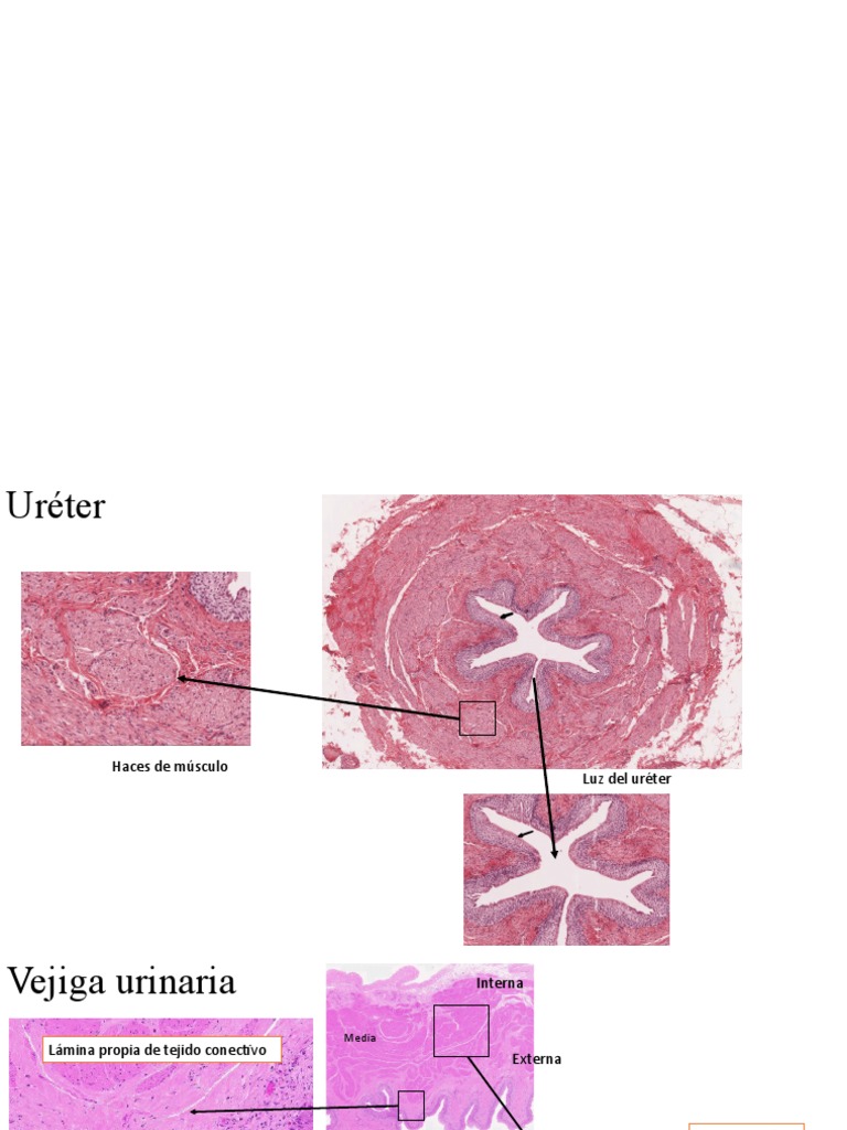 Ureter Y Vejiga Pdf