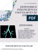 Estenosis e Insuficiencia Valvular