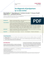 Diverse presentations of peripartum cardiomyopathy