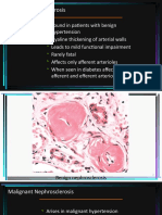 Benign Nephrosclerosis