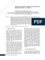 Treatment of Gingival Recession Using Coronally PDF