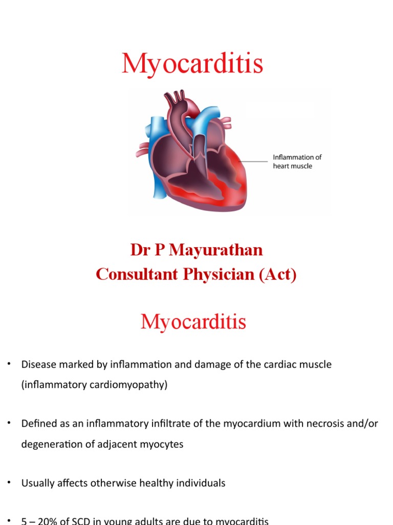 Understanding Myocarditis and Pericarditis | PDF | Heart | Internal ...